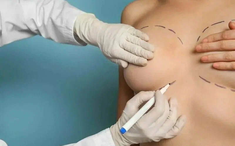 Cirurgia mamária funcional, nódulos e ginecomastia 